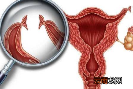 二胎剖腹产后做结扎手术