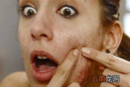 毛孔粗大可以用啤酒洗脸吗